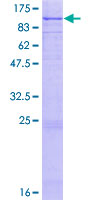 12.5% SDS-PAGE Stained with Coomassie Blue